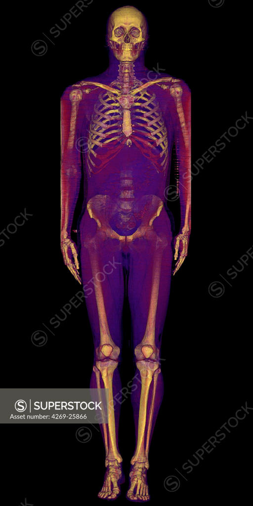 Body D Computed Tomographic Ct Scan Reconstruction Longitudinal