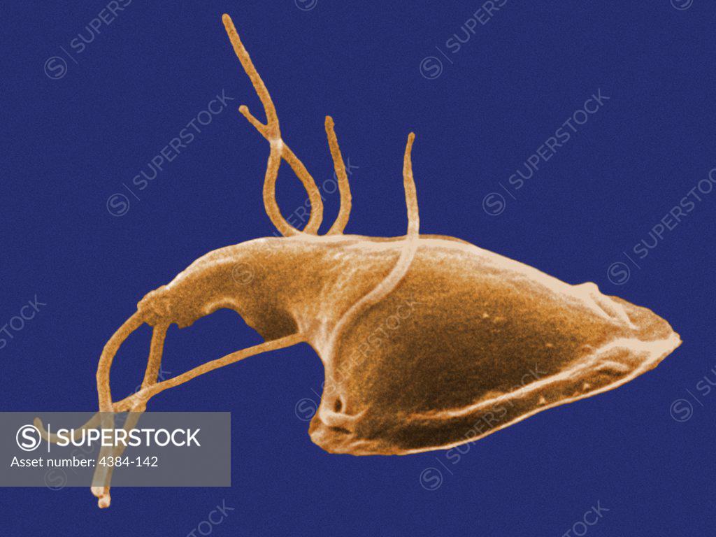 This Digitally Colorized Scanning Electron Micrograph Sem Depicted