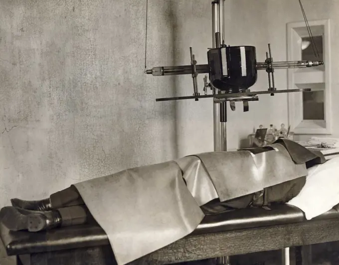 New York, New York:  May 16, 1924 A cancer patient undergoing treatment from the new 200,000 volt super x-ray machine developed at Columbia University by the Department of Physics and engineers from General Electric. The patient must be protected by lead shields with only the cancer area exposed.