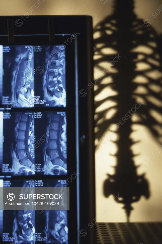 Scans of human spinal cord