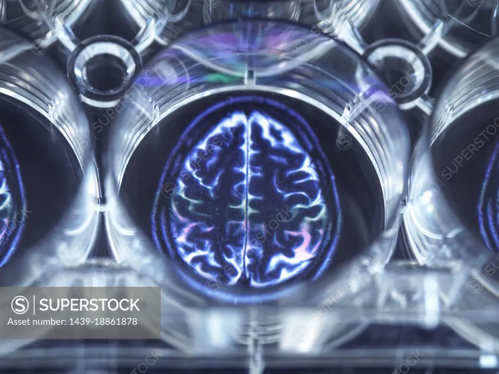 Pipetting potential cure for brain disorders into a multi well plate