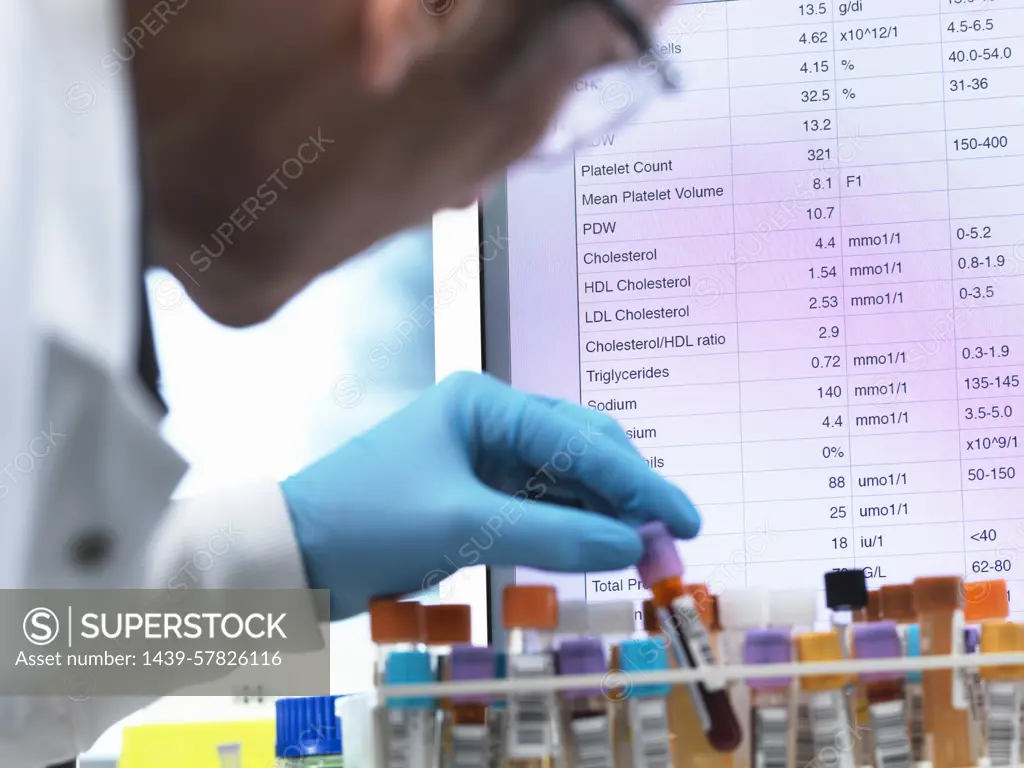 Medical Testing, Haematologist checking medical samples including blood for testing with results on the computer screen