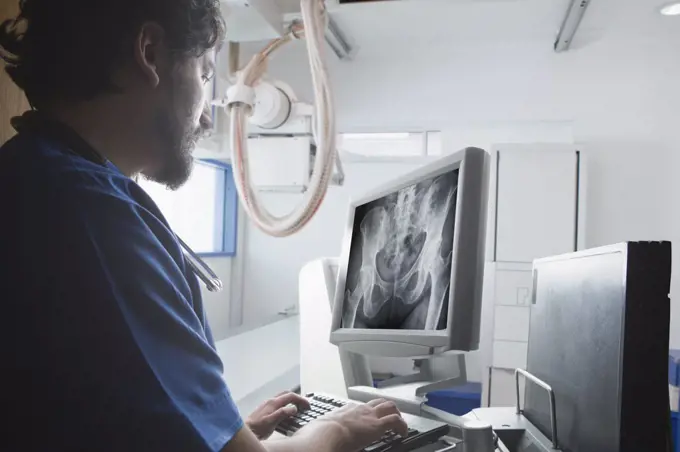 Young male radiographer looking at Xray of pelvis in radiology department