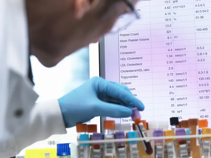 Medical Testing, Haematologist checking medical samples including blood for testing with results on the computer screen