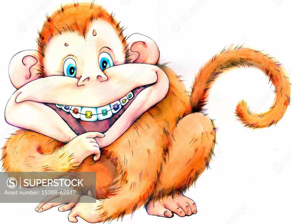 Monkey with braces - SuperStock