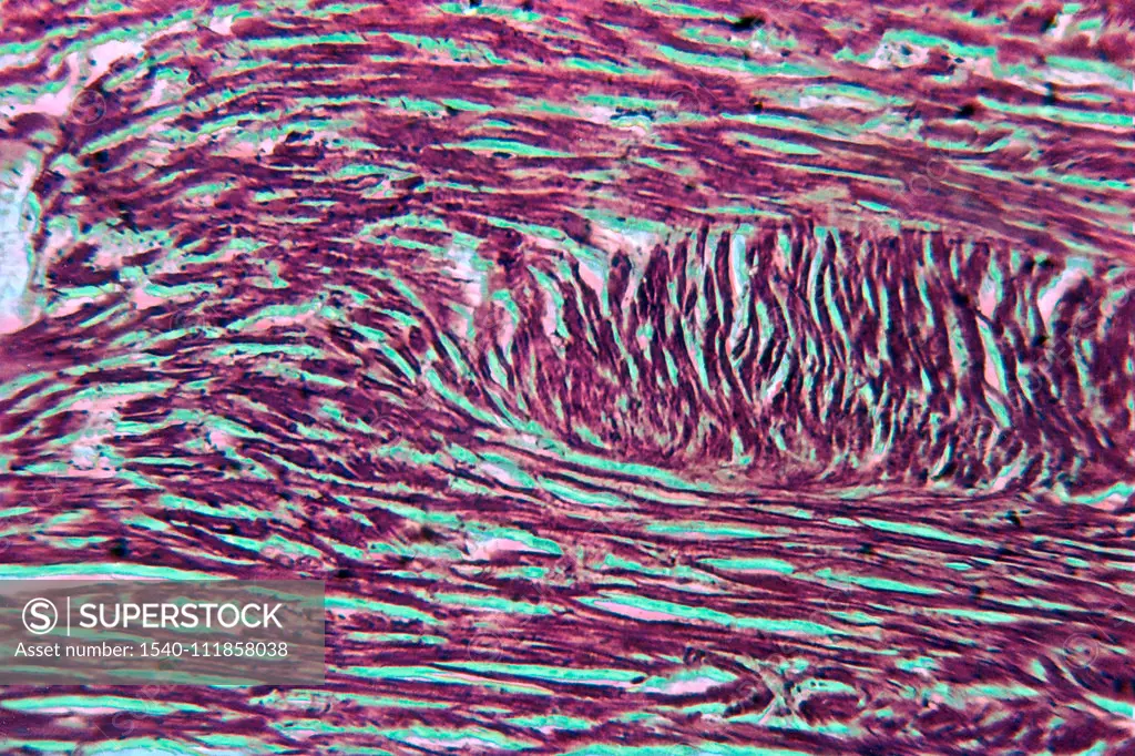 Heartflow , Pictorial art of transverse section of heart muscle was micro photographed. It was given digital treatment to show the flow and rhythmic movement in the heart