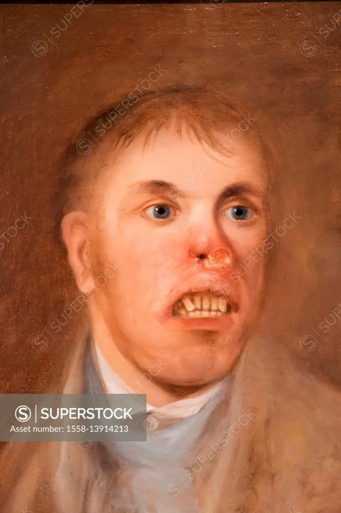 England, London, The Wellcome Collection, The Reading Room, Portrait of Mr J Kay Afflicted with a Rodent Disease c1820