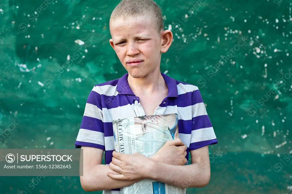 Albino boy holding his school book Ethiopia.