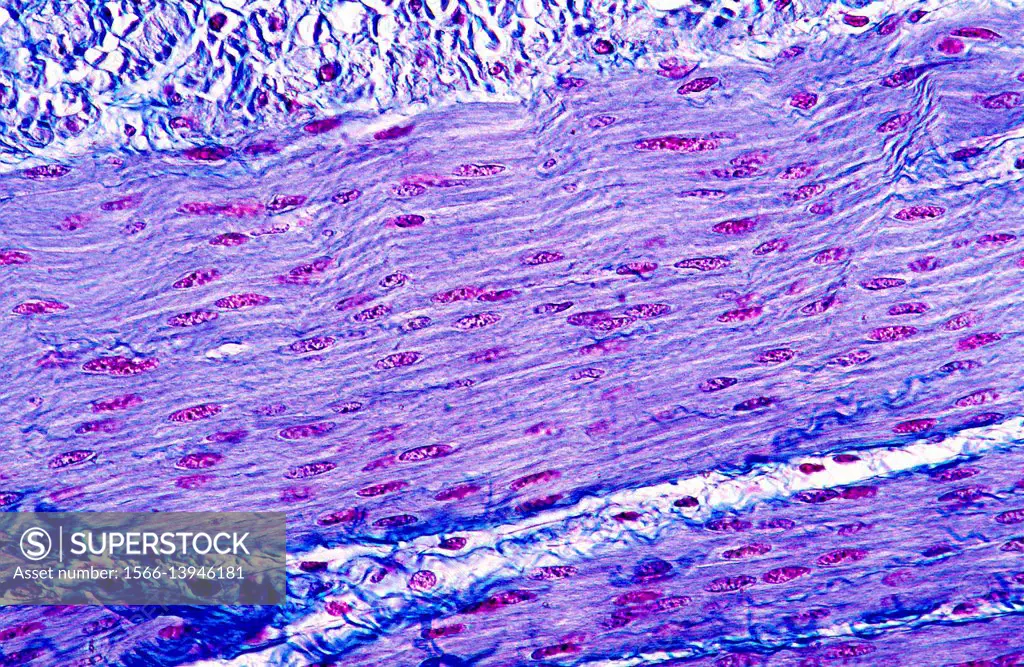 Smooth muscle tissue. Optical microscope, magnification X200.