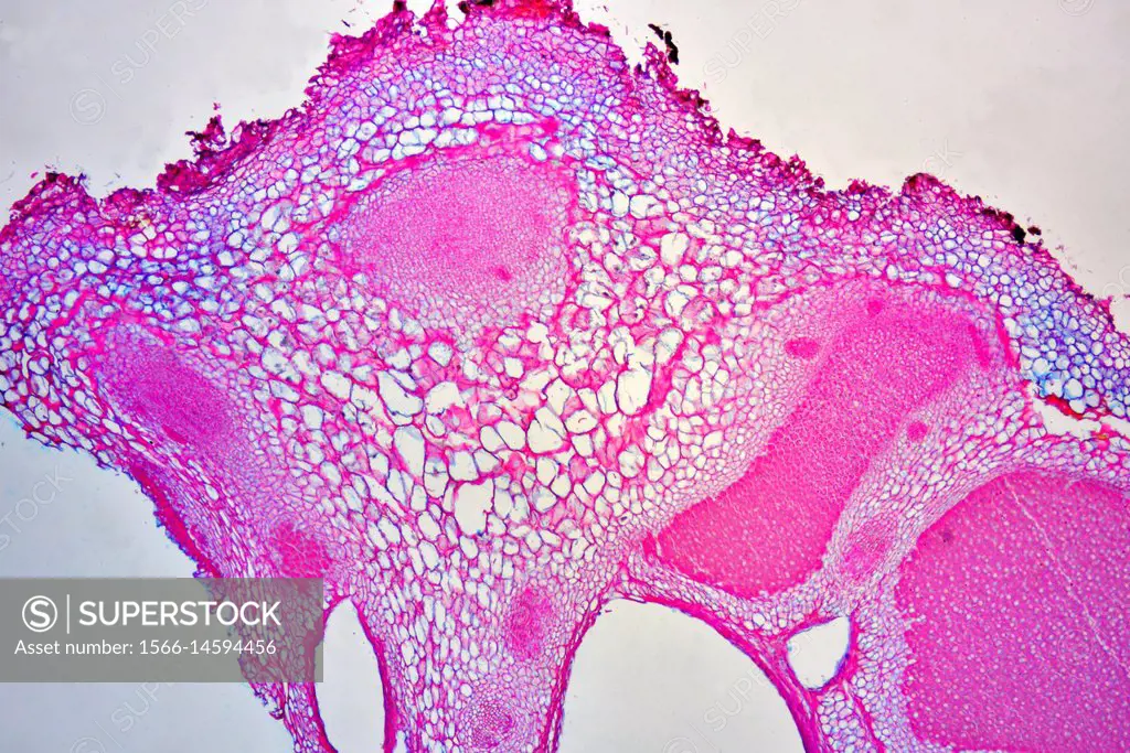 Lupinus root (cross section) with Rhizobium radicicola, fix nitrogen bacteria. Optical microscope X40.