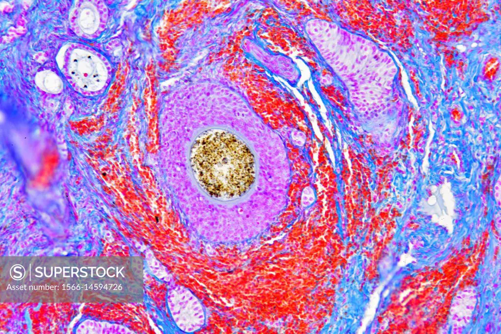 Human ovary section showing ovarian follicles or Graaf follicles. Optical microscope X200.