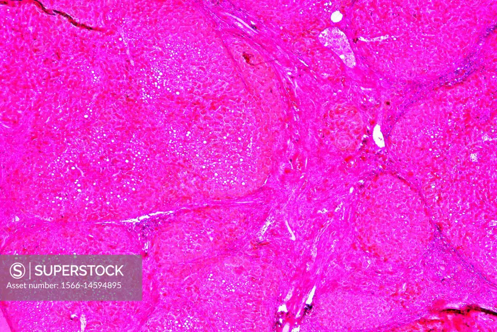 Human liver with cirrhosis. Optical microscope X40.