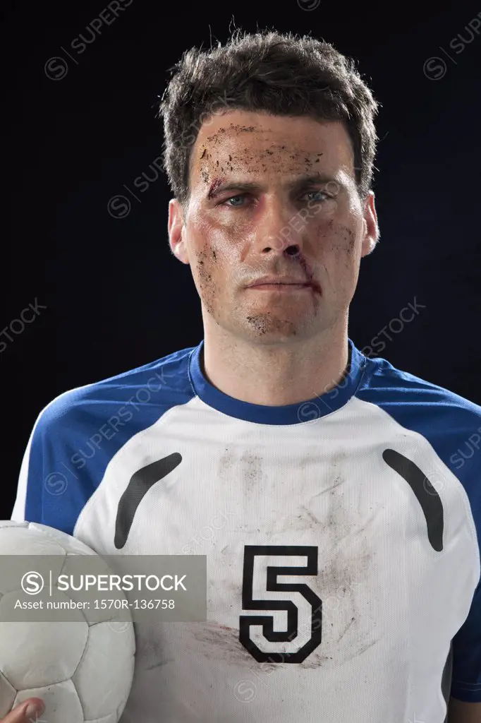 A soccer player with a bloody nose holding a soccer ball