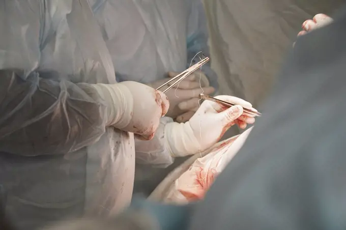 Midsection of medical team performing surgery in operating room