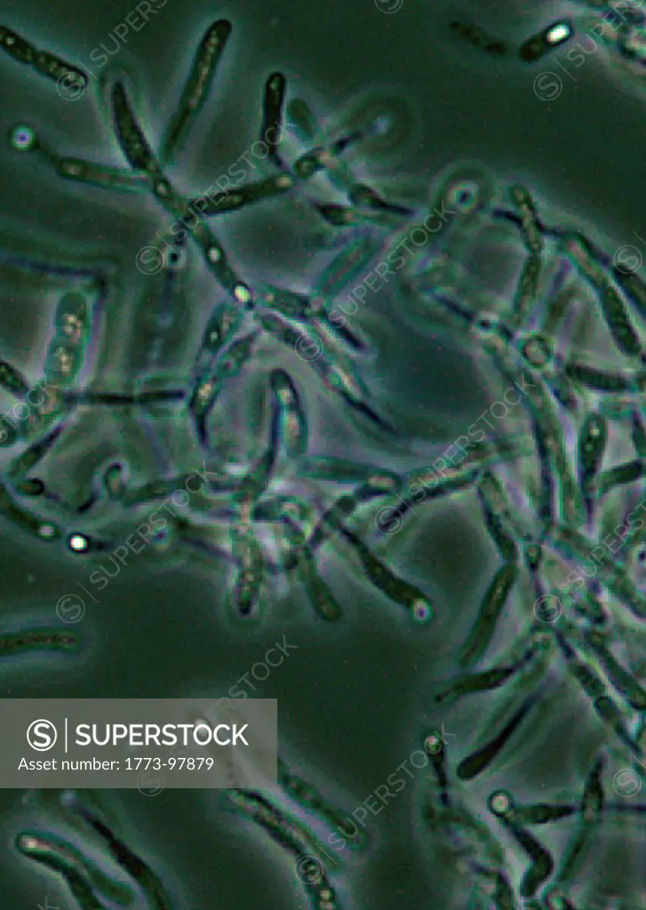 Photomicrograph of Bacillus anthracis spores