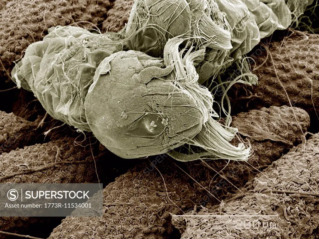 Eggs of Aedes Albopictus mosquito hatching SEM