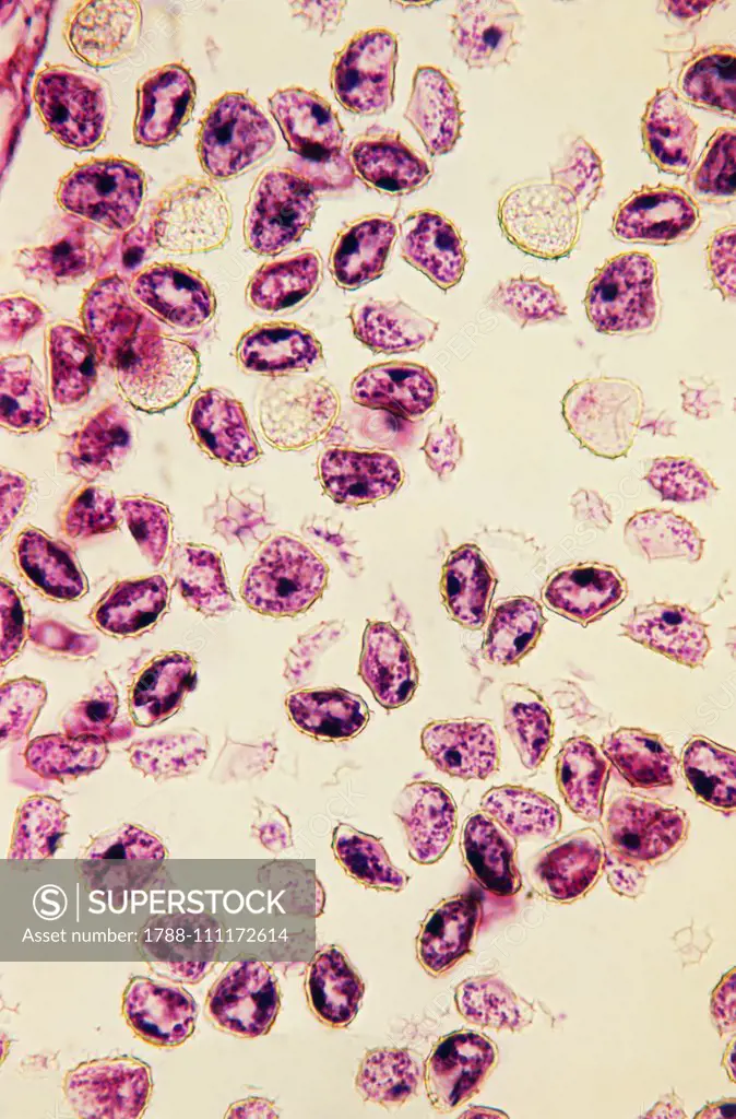 Lycopodium spores (genus Lycopodium), Lycopodiaceae, seen under a microscope.