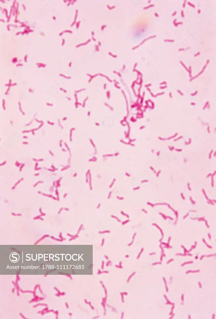 Vibrio cholerae, pathogenic enterobacteriaceae, seen under a microscope.