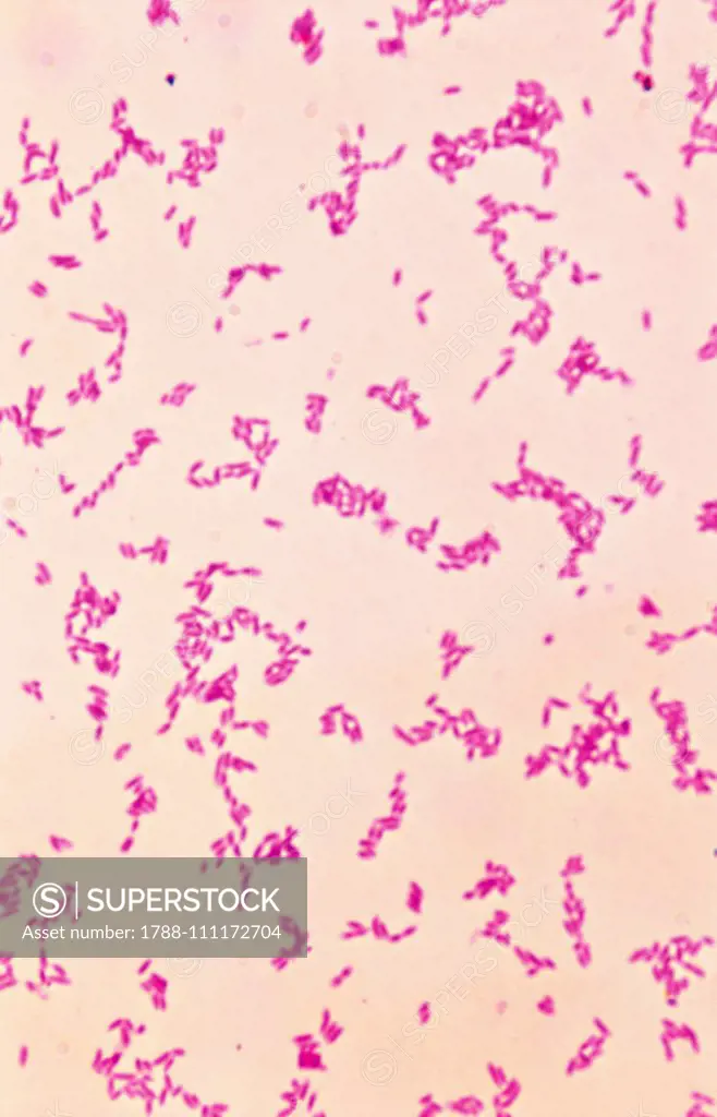 Yersinia pestis (formerly Pasteurella pestis), the bubonic plague bacterium, seen under a microscope.