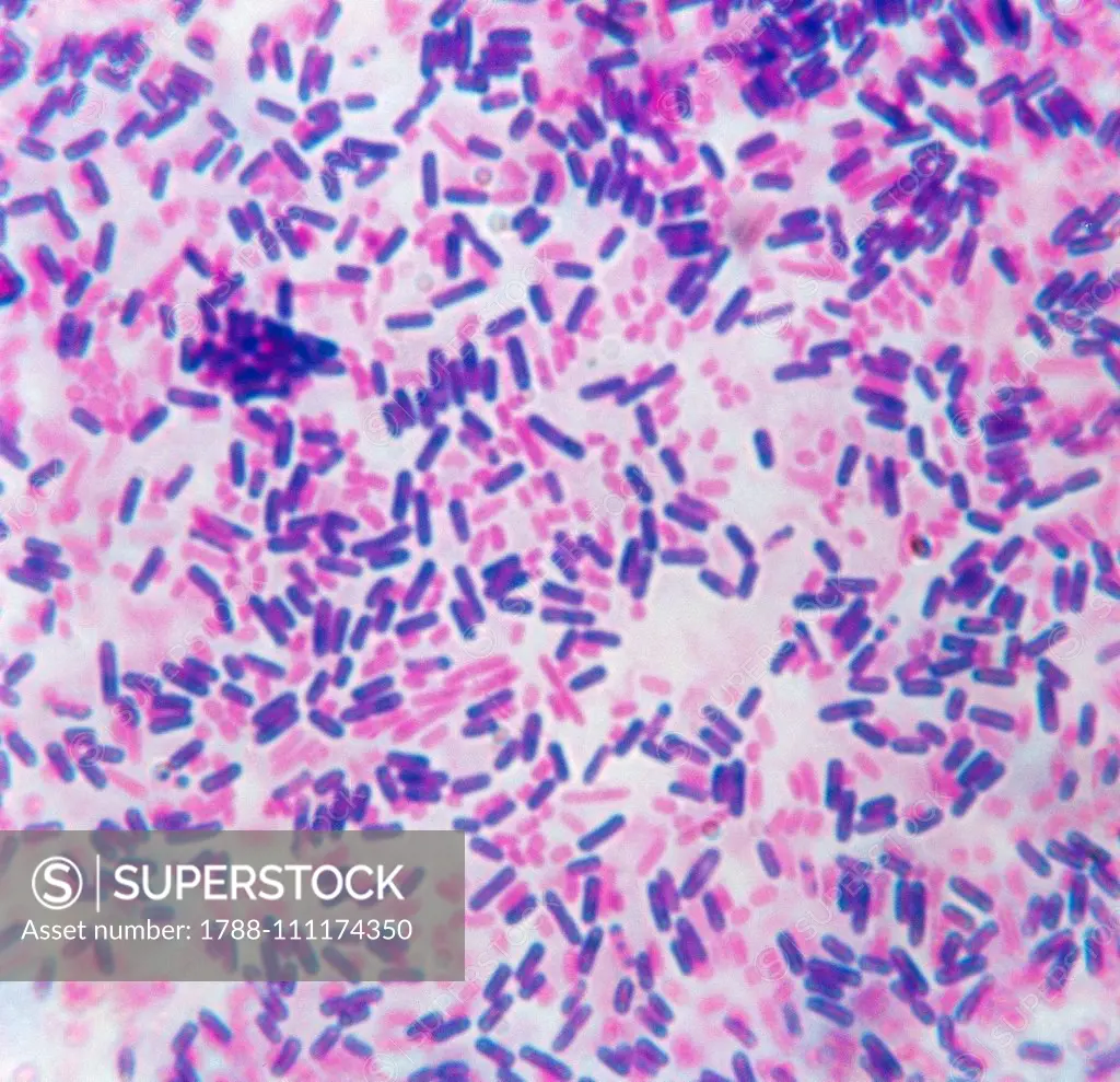 Microphotograph of an example of staining bacteria using the Gram method, at x1250 magnification.