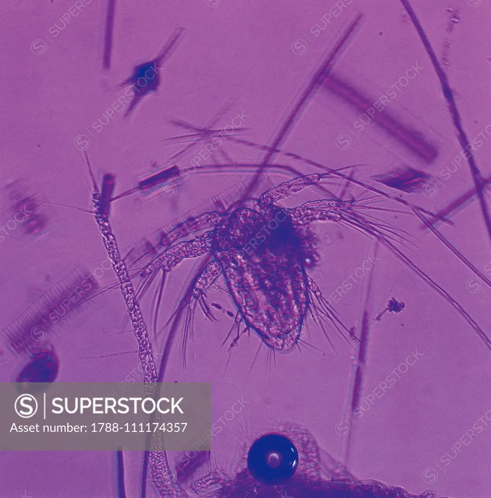 Nauplius of water flea (Cyclops), copepods, seen under a microscope.