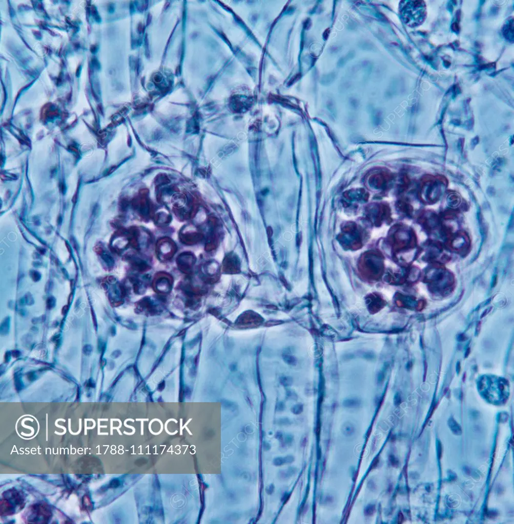 Antheridiums and antherozoids of a Dryopteris fern, phase contrast microscopy, at x400 magnification.