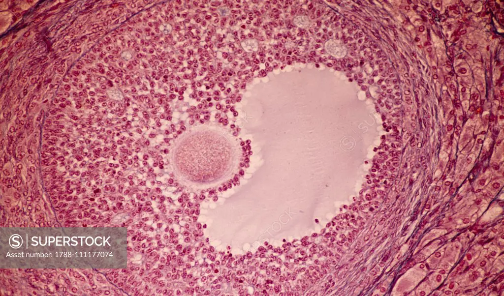 Antral follicle (or Graafian follicle), maturation stage with egg cells.