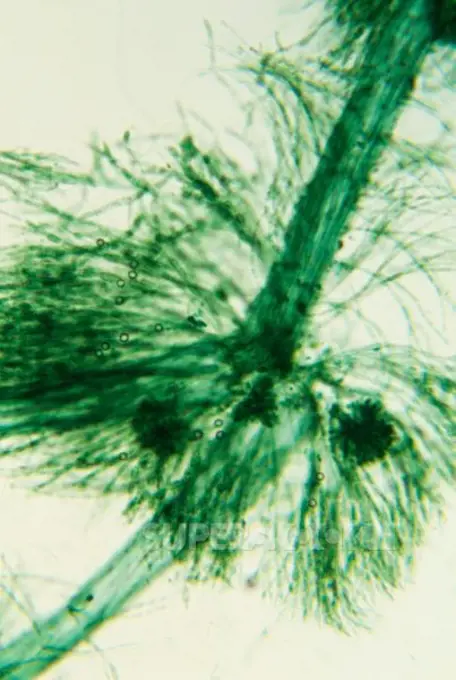 Batrachospermum, freshwater red algae viewed under a microscope.