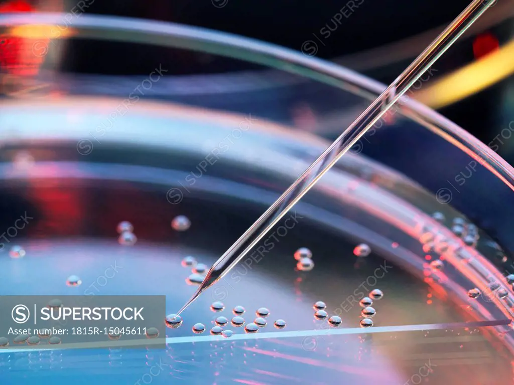 Stem cell research, nuclear transfer being carried out on several embryonic stem cells for cloning