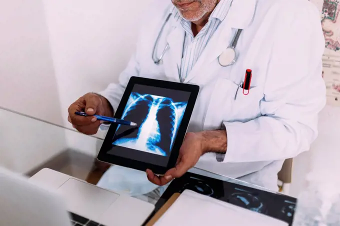 Senior male doctor explaining x-ray on digital tablet in hospital