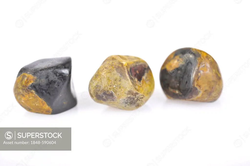 Gall stones, biliary calculi