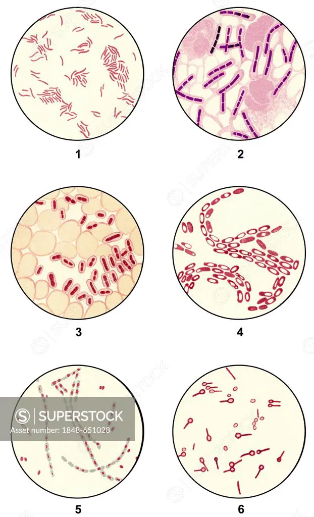 Bacteria smears of germs for microbiological diagnosis, microscope slides, clinical microbiology, state of scientific research around 1915, 1: Vibrio ...