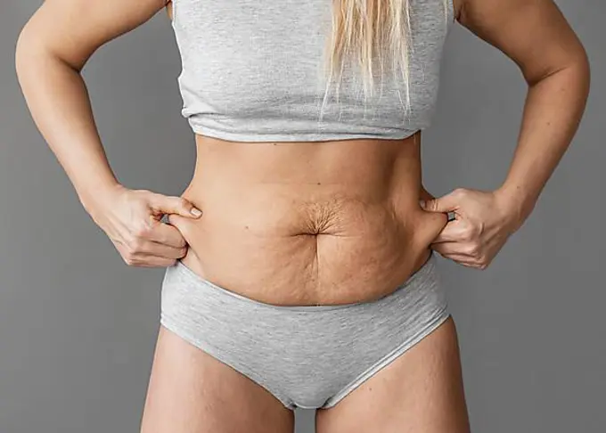 Close up woman holding belly fat