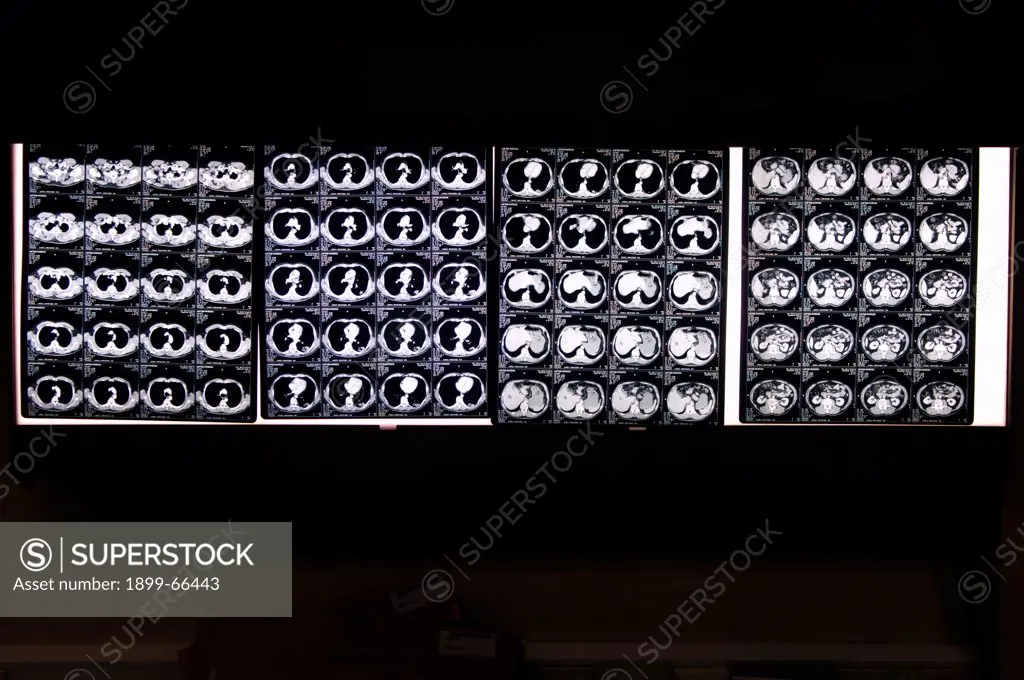 CT scan images of human head