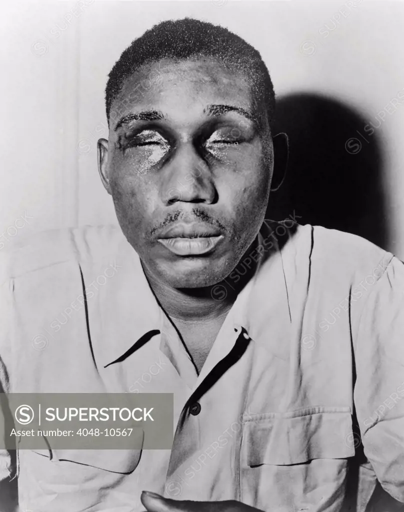 African American man with eyes swollen shut from beating. Ca. 1945-50,