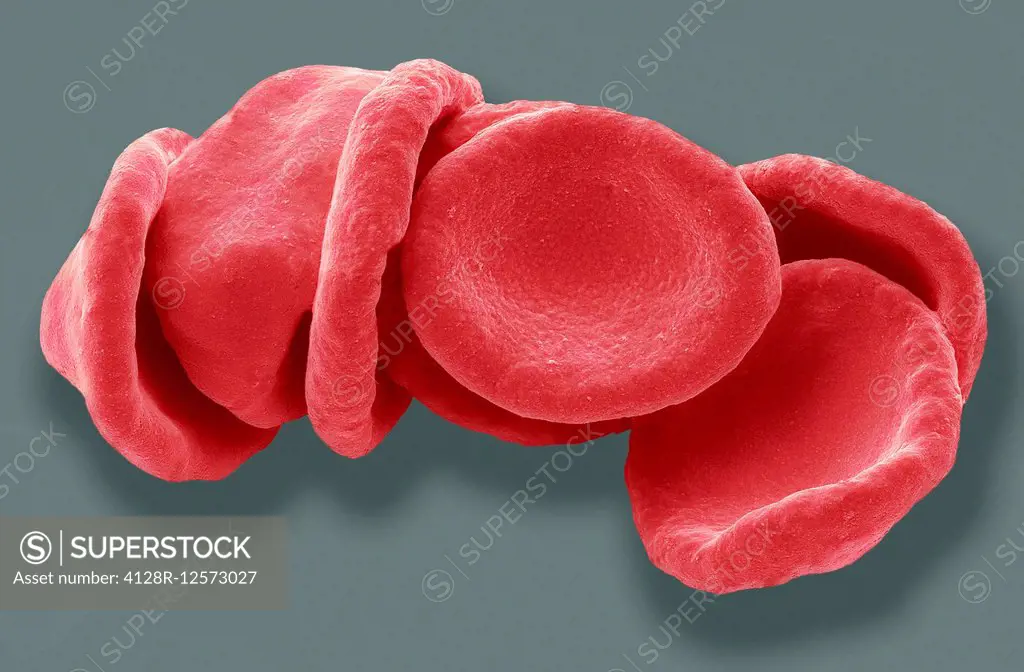 Red blood cells. Coloured scanning electron micrograph (SEM) of red blood cells (RBCs, erythrocytes). Red blood cells are biconcave, disc-shaped cells...