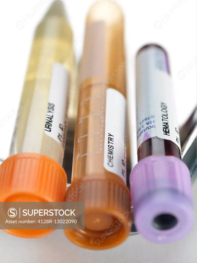 A variety of human samples, including blood and urine, awaiting testing.