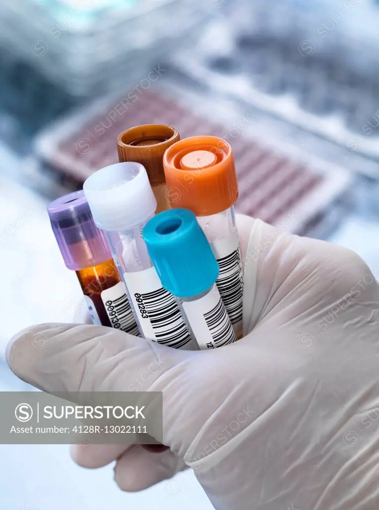 Technician holding a variety of human samples, including blood, chemistry and urine, for testing in a laboratory.