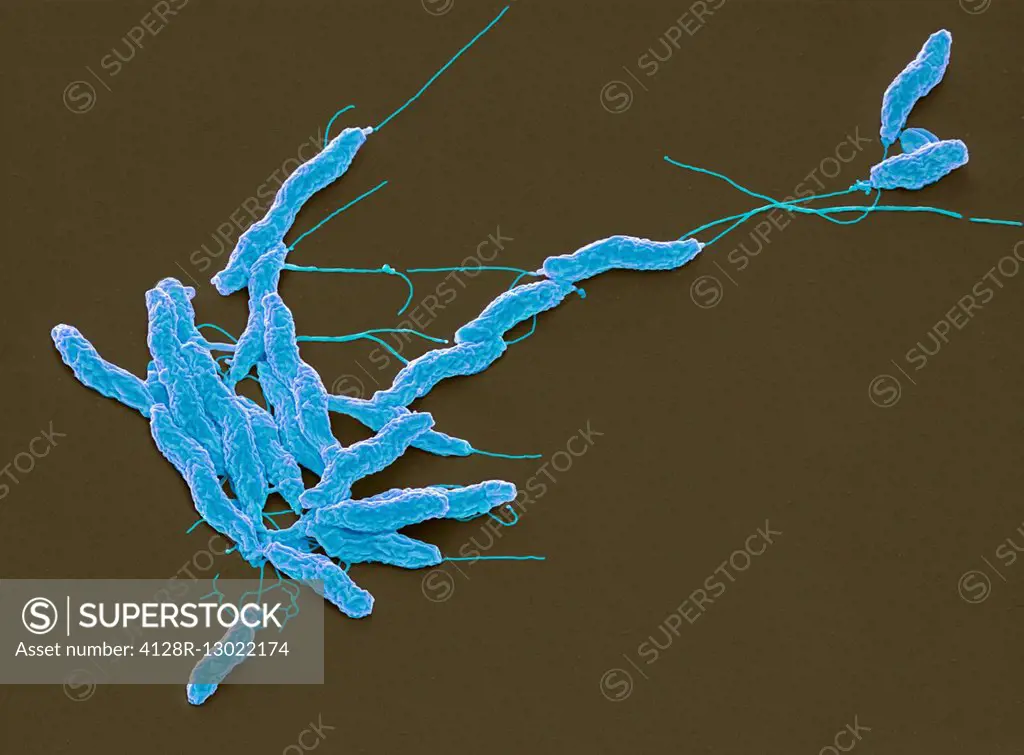 Campylobacter jejuni bacteria. Coloured scanning electron micrograph (SEM) of a Campylobacter jejuni bacteria. Campylobacter jejuni is a Gram-negative...