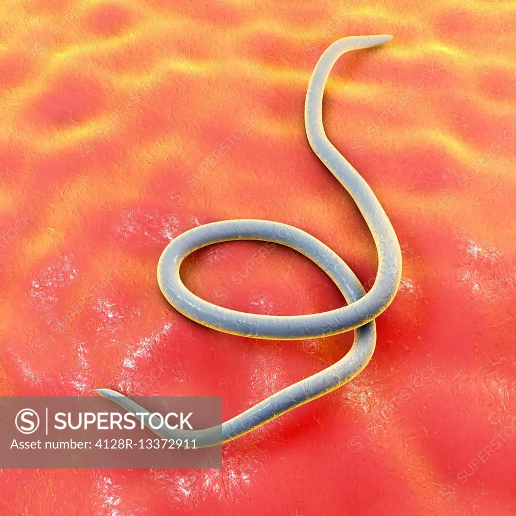 Threadworm, computer illustration. Threadworms are nematode worms that parasitize the large intestine and caecum of many animals. In humans they cause...