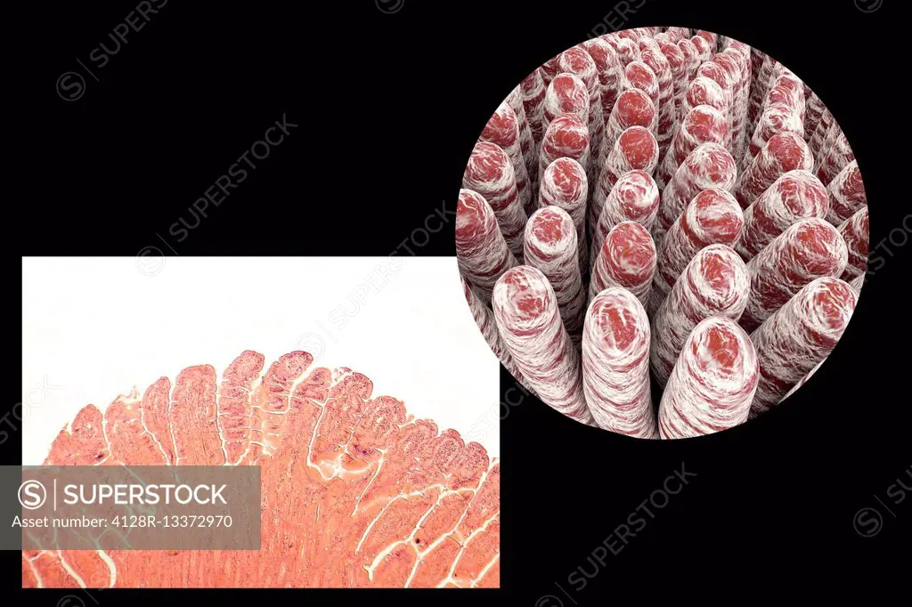 Intestinal villi, light micrograph and 3D computer illustration. Villi are finger-like projections that greatly increase the intestinal surface area f...