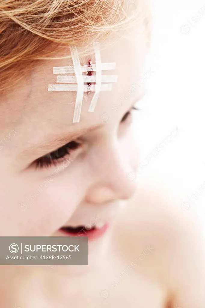 Young boy with head wound. The wound is closed with steri_strips.