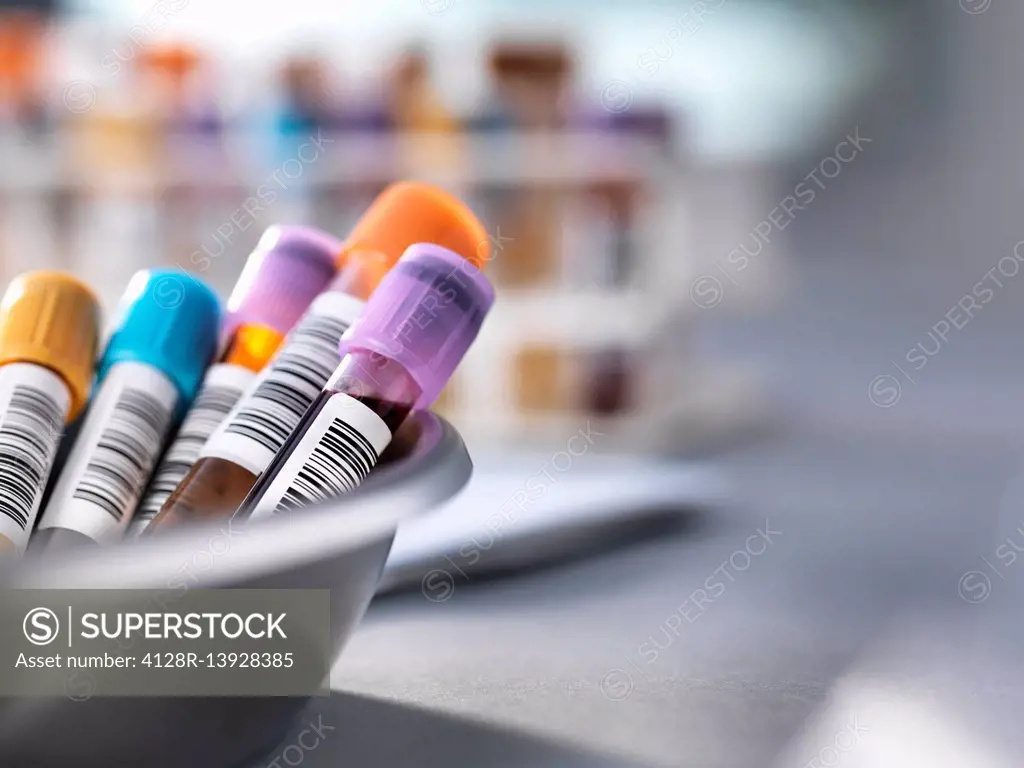 Tray of human medical samples awaiting clinical testing in a laboratory.