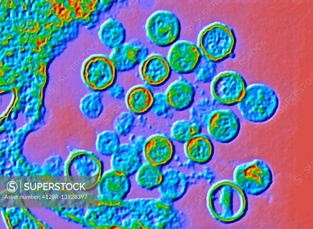 Color enhanced transmission electron micrograph (TEM) of Hantavirus particles. Hantavirus is a respiratory disease carried in wild rodents such as dee...