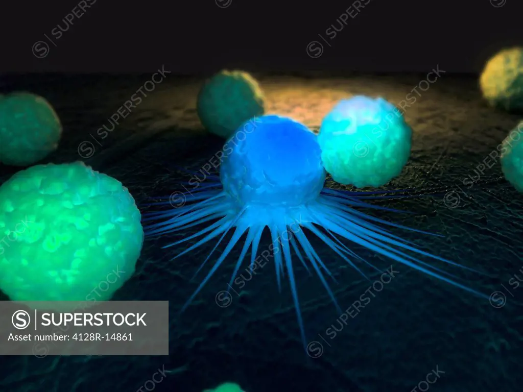 Immune response to cancer. Computer artwork of white blood cells green attacking a cancerous cell blue.