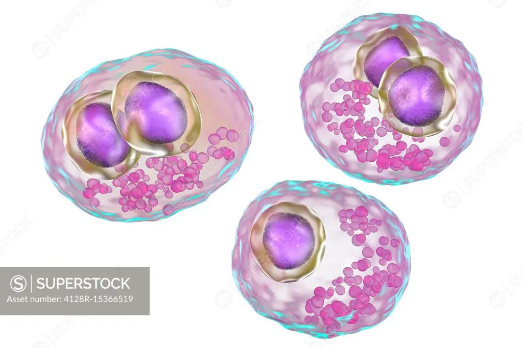 Cytomegalovirus infection, illustration