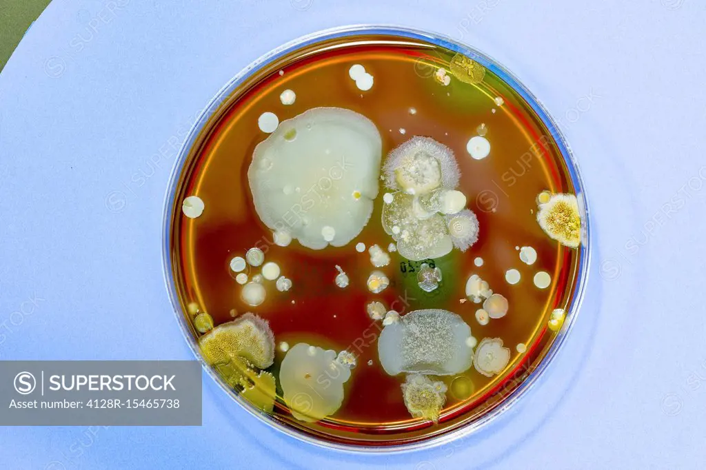 Microbes growing in Petri dish