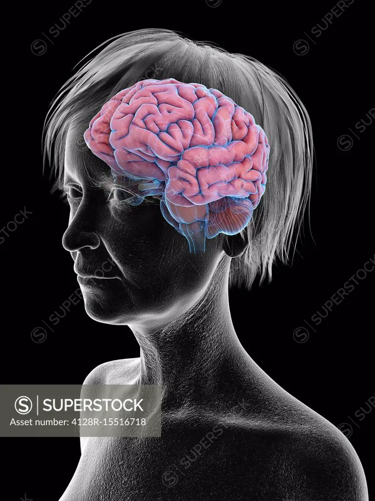 Illustration of an old woman's brain