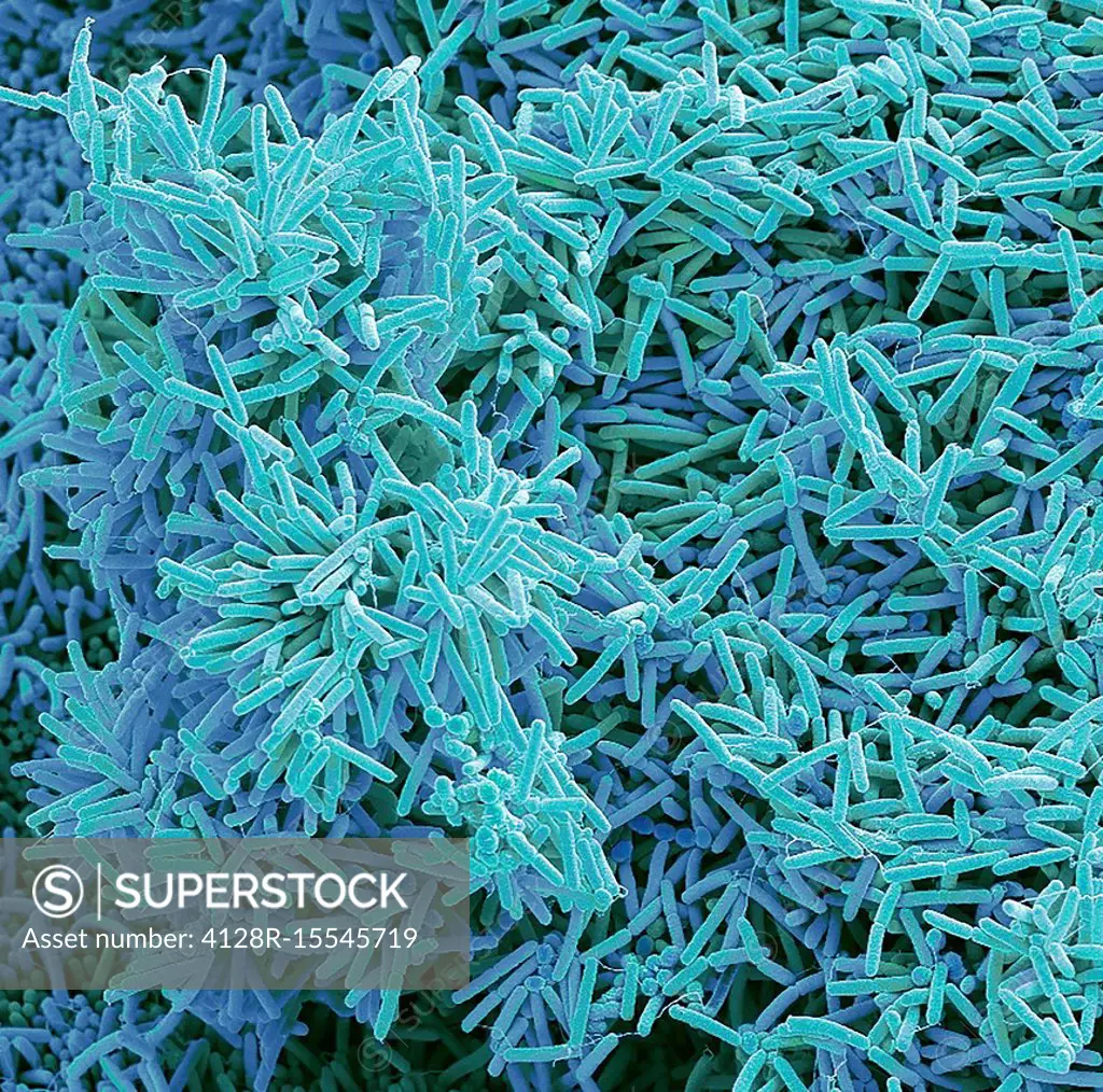 Plaque-forming bacteria, SEM