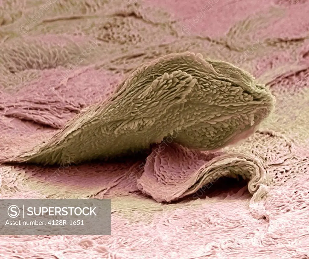 Skin cell. Coloured scanning electron micrograph SEM of a squamous cell on the surface of the skin. This is a flat, keratinised, dead cell. Squamous c...